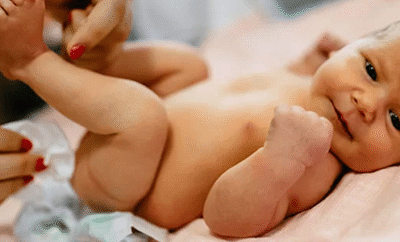 جراحات حديثي الولادة والاختلافات الخِلقية